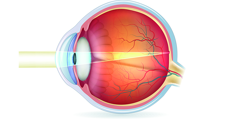 schéma de l'oeil et du chemin optique de la lumière sur la Macula