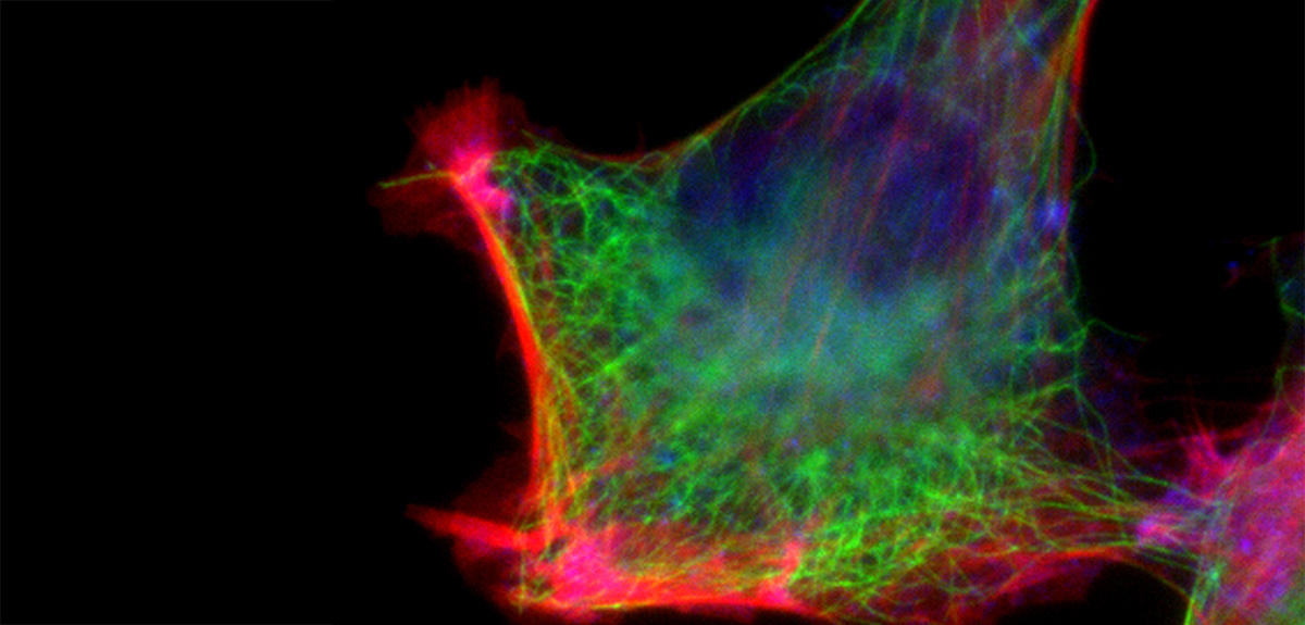 Cytosquelette et Actine les cellules sous pression /CNRS Images C. PLESTANT/R.-M. MEGE