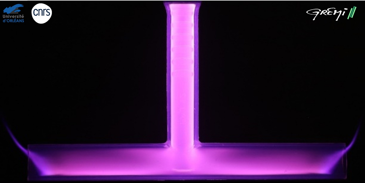 jet de plasma froid à l'intérieur d'une prothèse de sténose trachéale